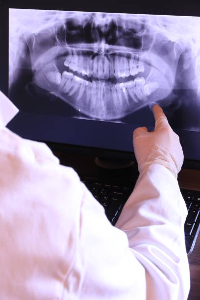 Best Emergency Denture Repair in Montura, FL