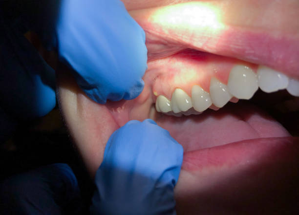 Best Pediatric Emergency Dentist in Montura, FL