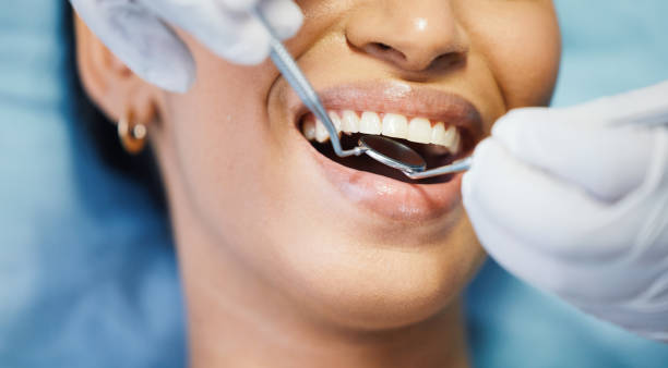 Best Emergency Dental Care for Broken or Chipped Teeth in Montura, FL